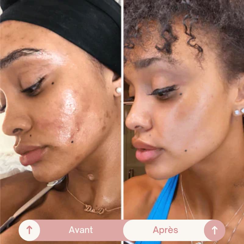 MADA™ Collagen Mask